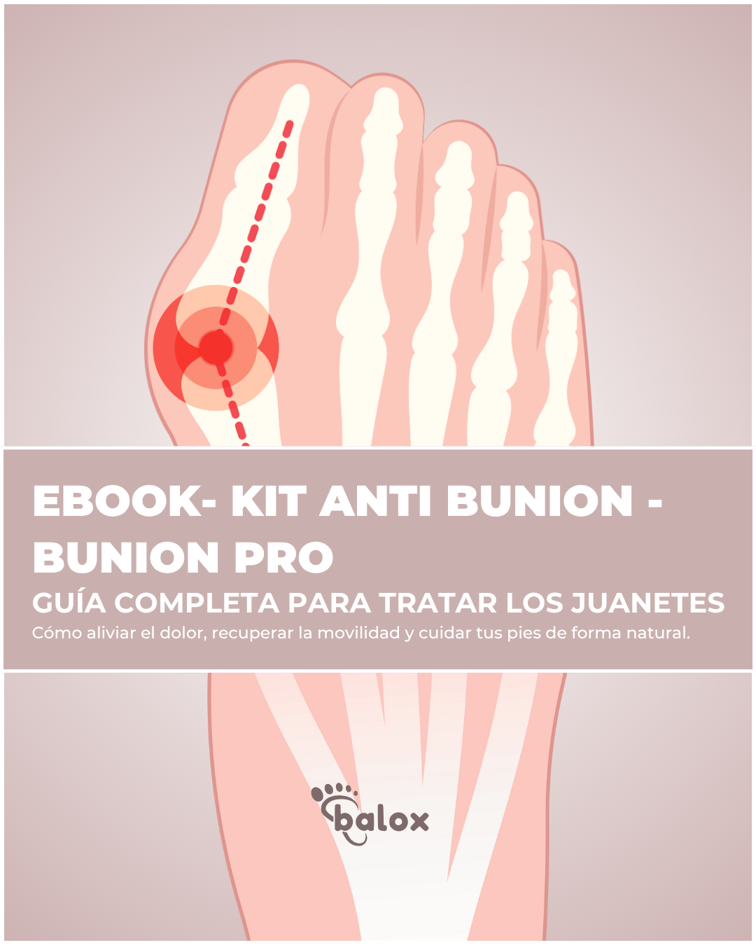 EBOOK - GUÍA COMPLETA PARA REALINEAR EL JUANETE DE FORMA NATURAL SIN CIRUGÍA