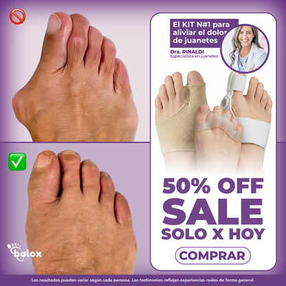 KIT ANTI BUNION ORTOPEDICO