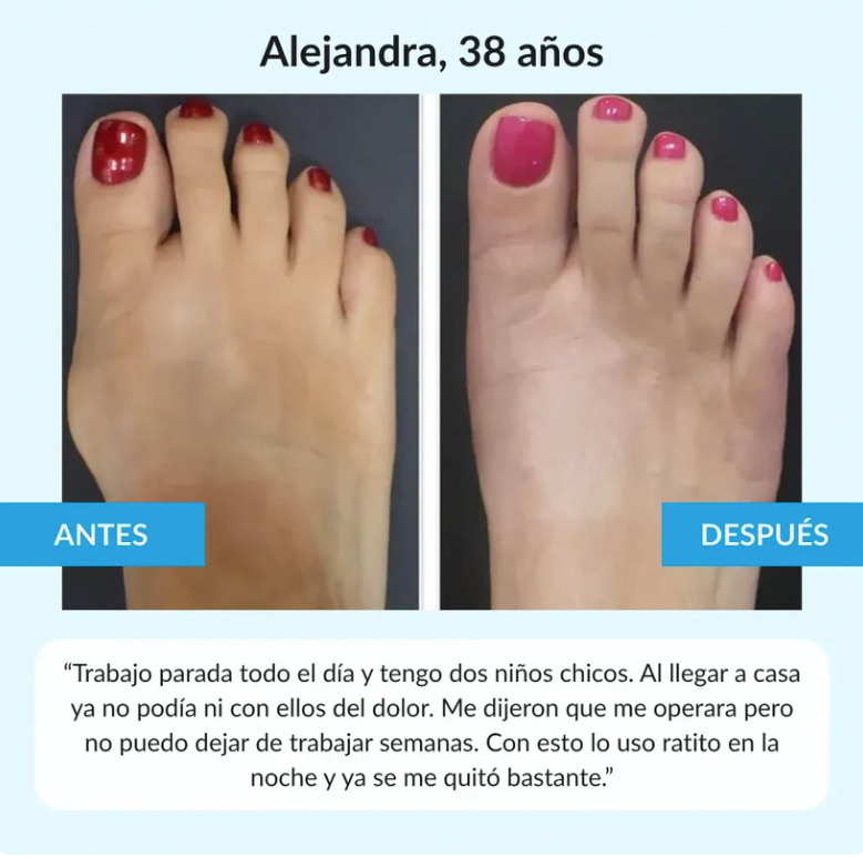 Juanex® | Corrector de Juanetes | ¡PRECIO ESPECIAL 50% OFF!