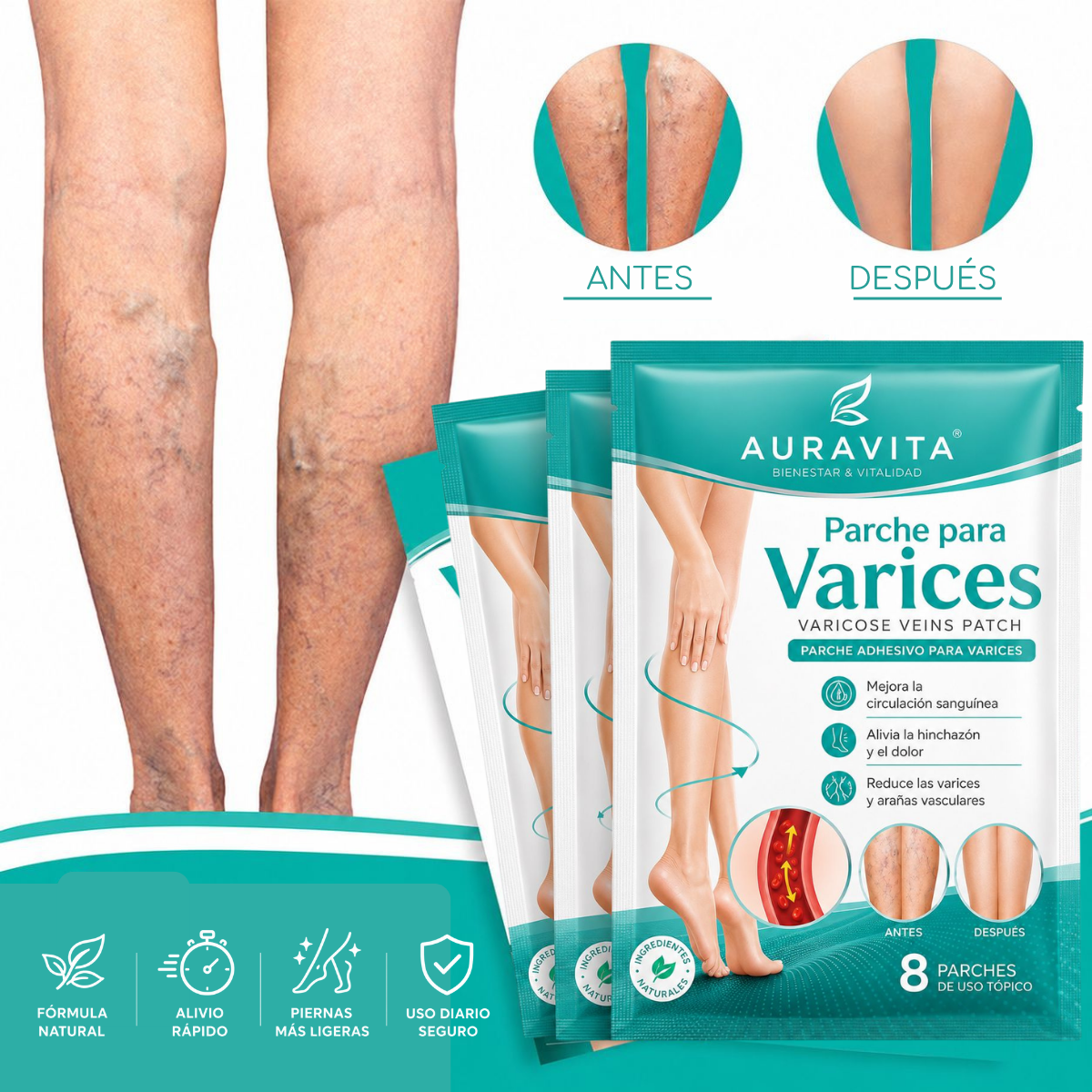 Varinex® | Tratamiento de Varices | ¡PRECIO ESPECIAL 50% OFF!