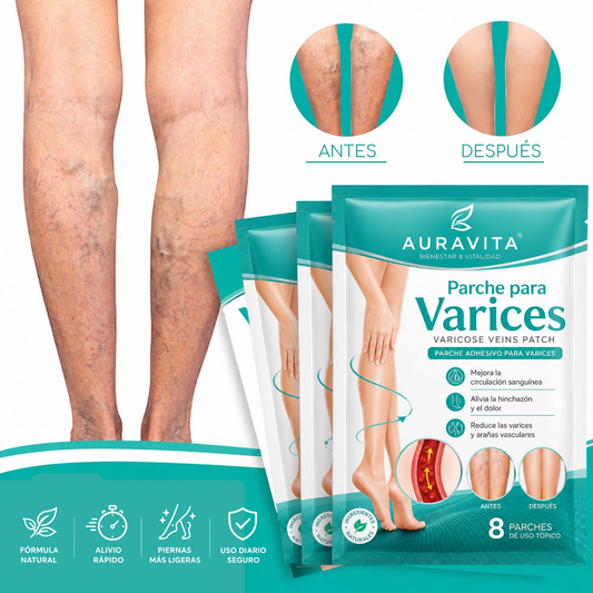 Varinex® | Tratamiento de Varices | ¡PRECIO ESPECIAL 50% OFF!