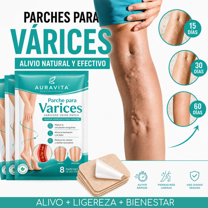 Varinex® | Tratamiento de Varices | ¡PRECIO ESPECIAL 50% OFF!
