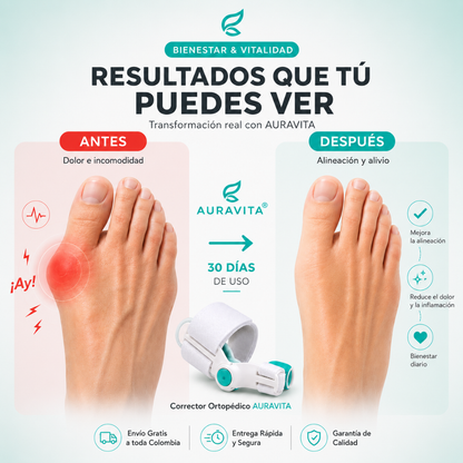 Juanex® | Corrector de Juanetes | ¡PRECIO ESPECIAL 50% OFF!
