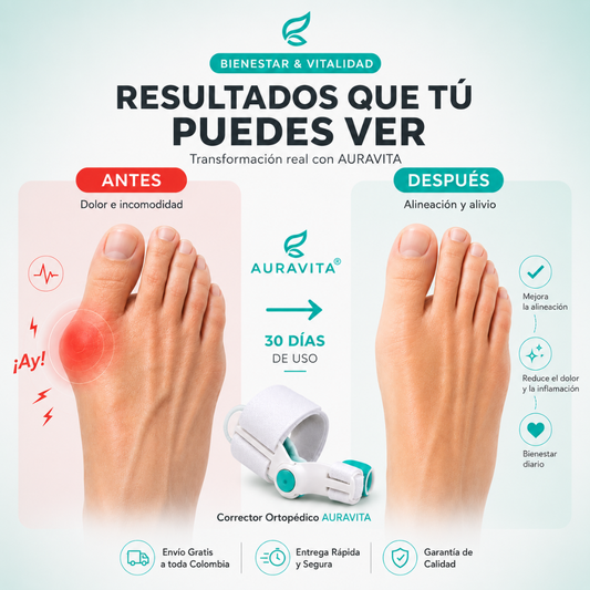 Juanex® | Corrector de Juanetes | ¡PRECIO ESPECIAL 50% OFF!
