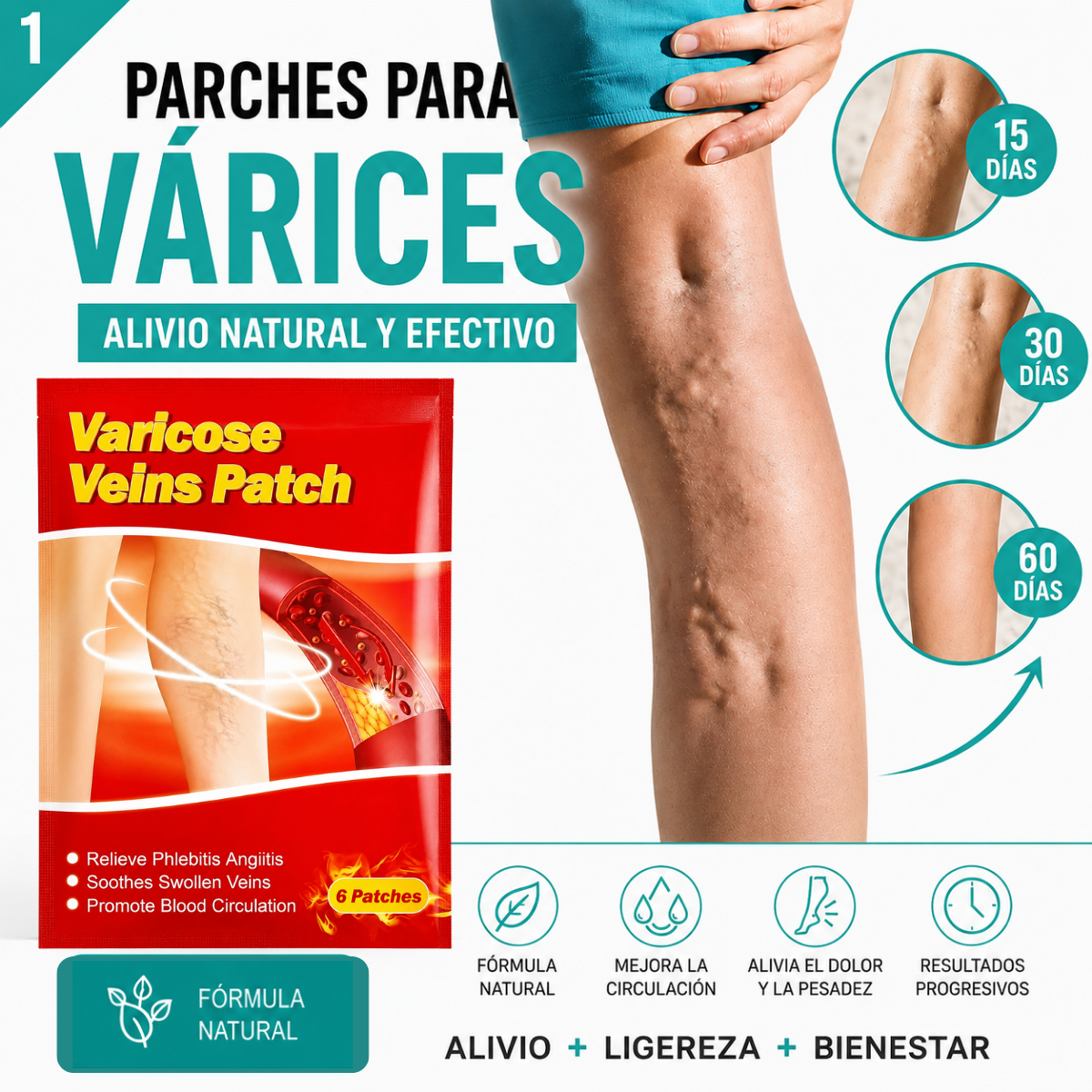 Varinex® | Tratamiento de Varices | ¡PRECIO ESPECIAL 50% OFF!