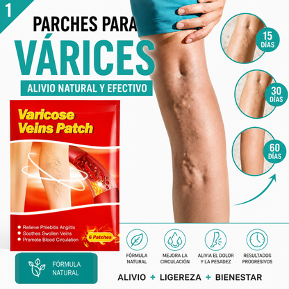 Varinex® | Tratamiento de Varices | ¡PRECIO ESPECIAL 50% OFF!
