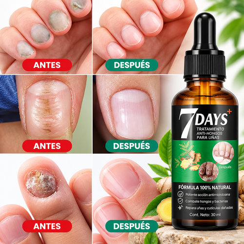 FUNGI STOP PRO | Sérum Antihongos para Uñas | ¡OFERTA EXCLUSIVA DE HOY!